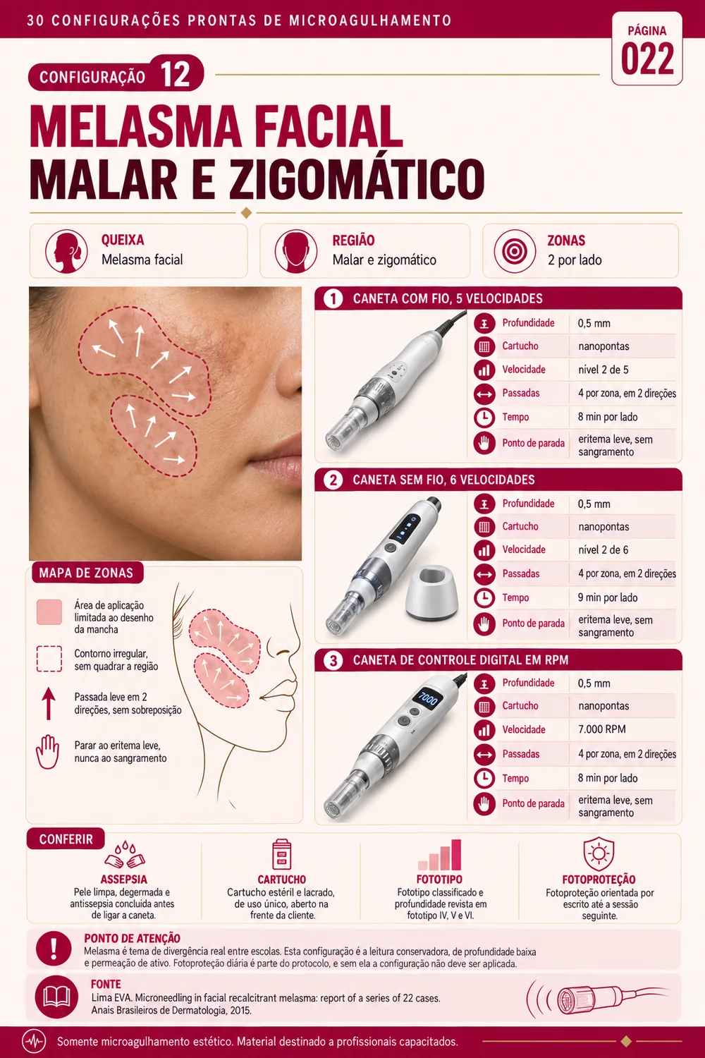 Ficha de melasma facial em região malar e zigomática
